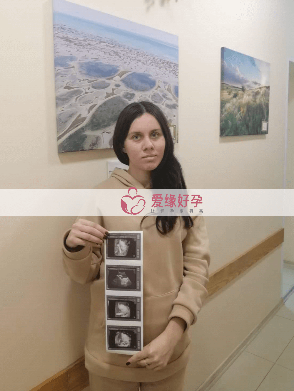 哈萨克斯坦乌克兰试管婴儿助孕爱心妈妈23周产检顺利通过