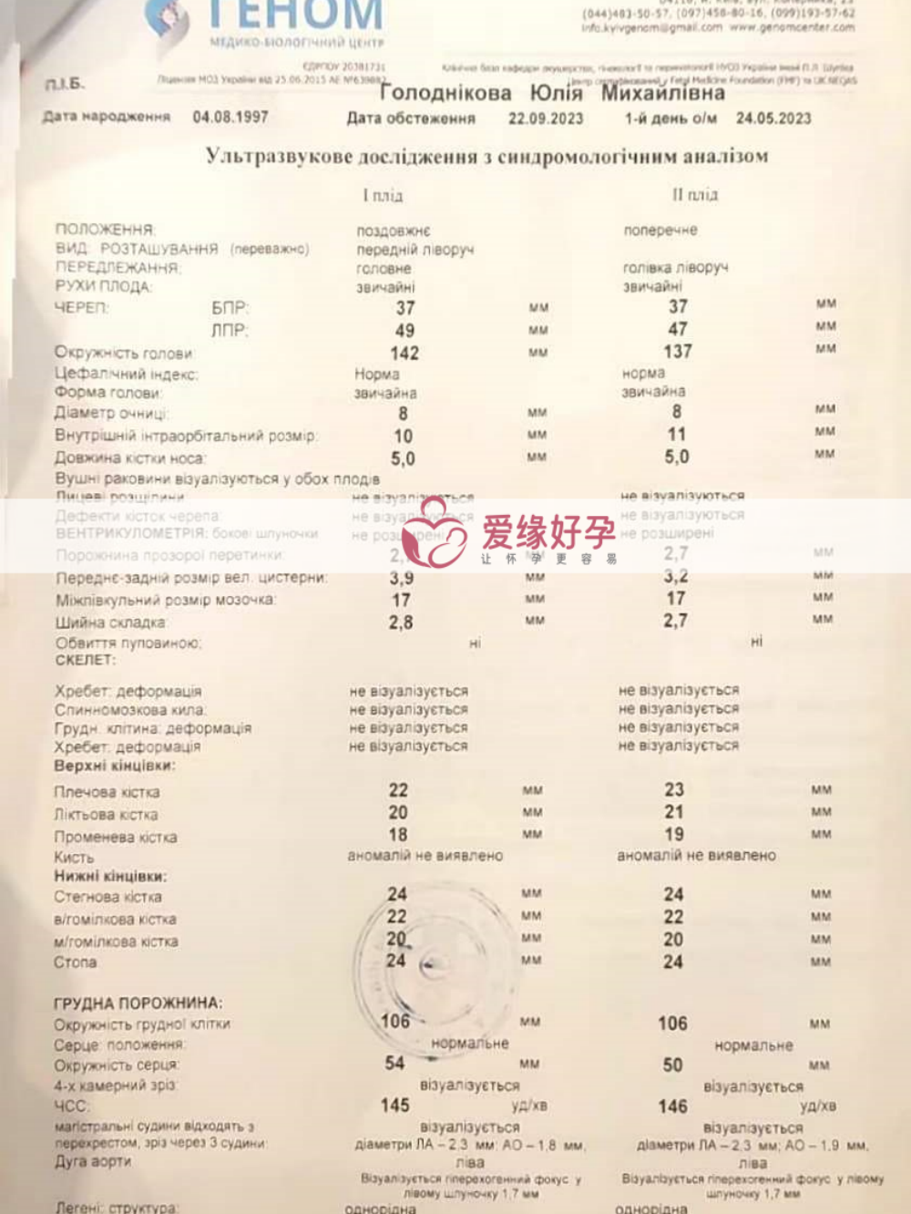 台湾委托父母同暖双胞胎17周检查顺利通过！