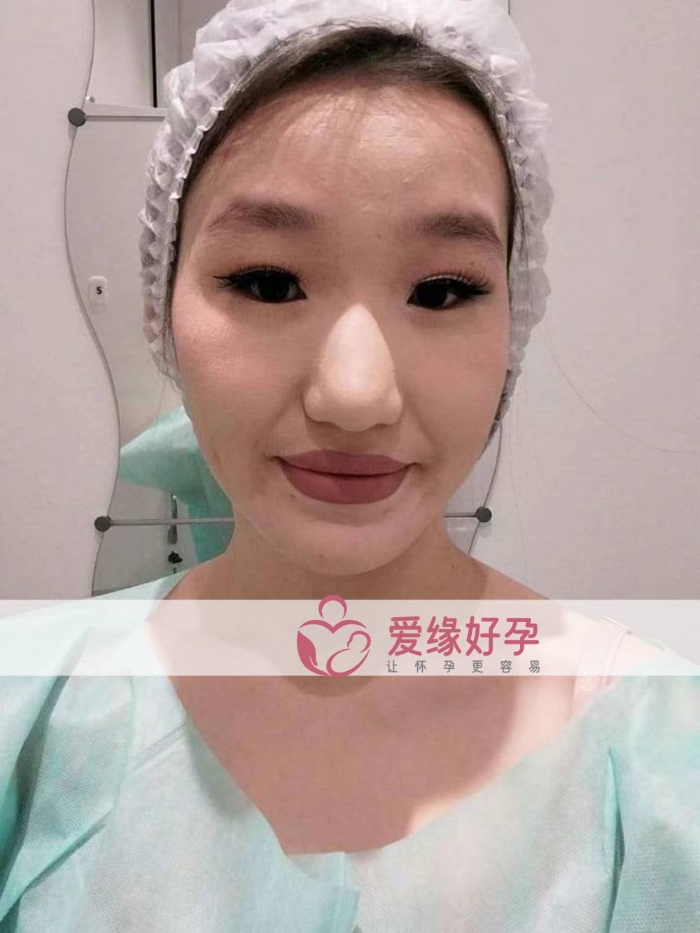 哈萨克斯坦试管婴儿助孕妈妈今天移植一颗囊胚