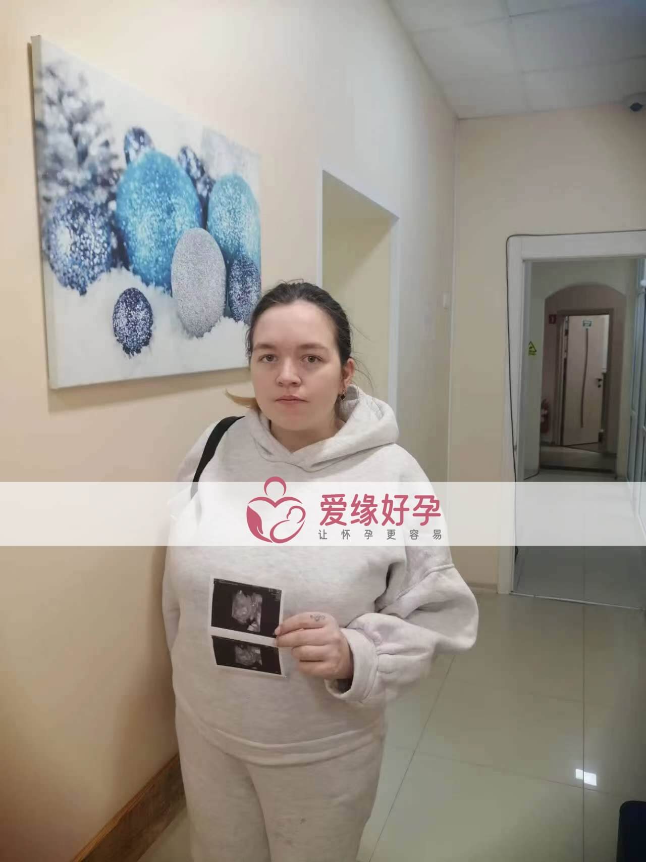 试管婴儿助孕爱心妈妈26周产检顺利通过