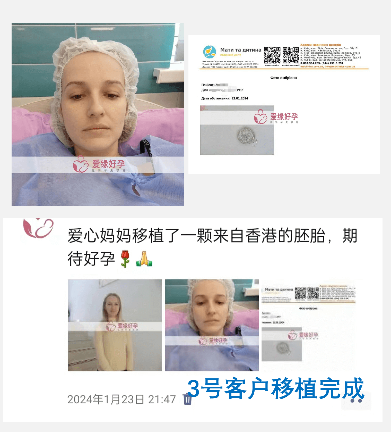 格鲁吉亚、哈萨克斯坦、乌克兰试管婴儿助孕移植着床成功率是多少了？