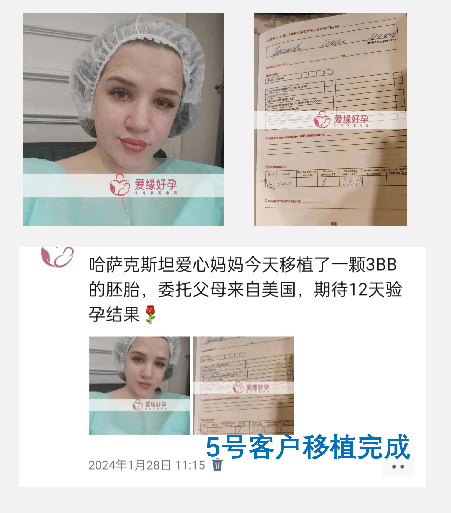 格鲁吉亚、哈萨克斯坦、乌克兰试管婴儿助孕移植着床成功率是多少了？