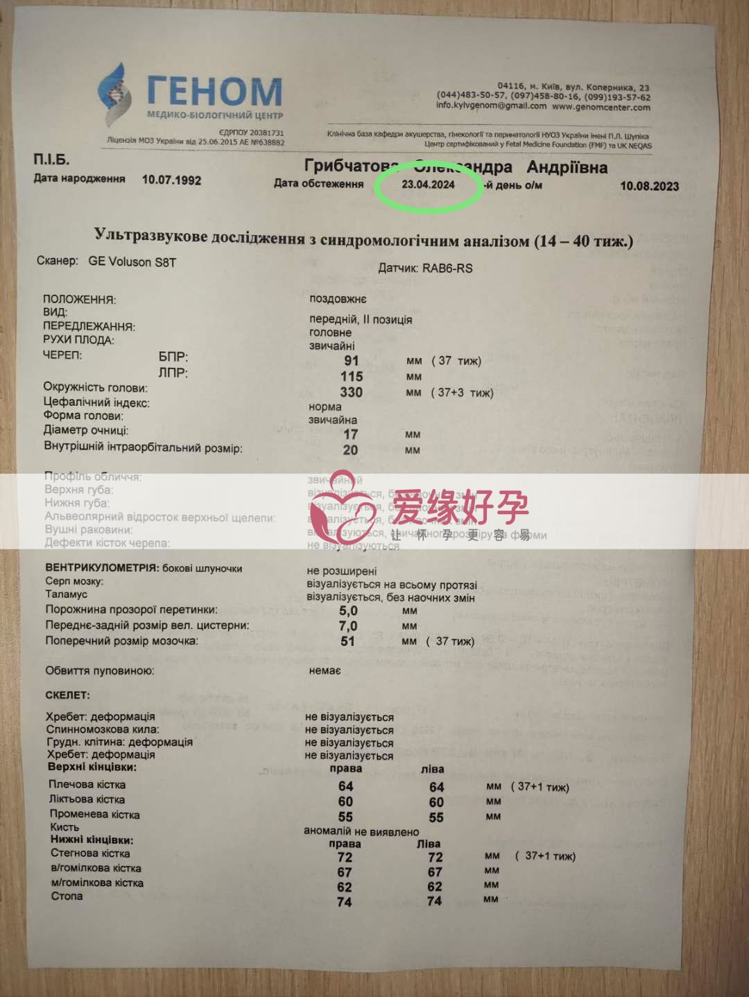 爱缘好孕：乌克兰爱心妈妈37周孕检顺利通过