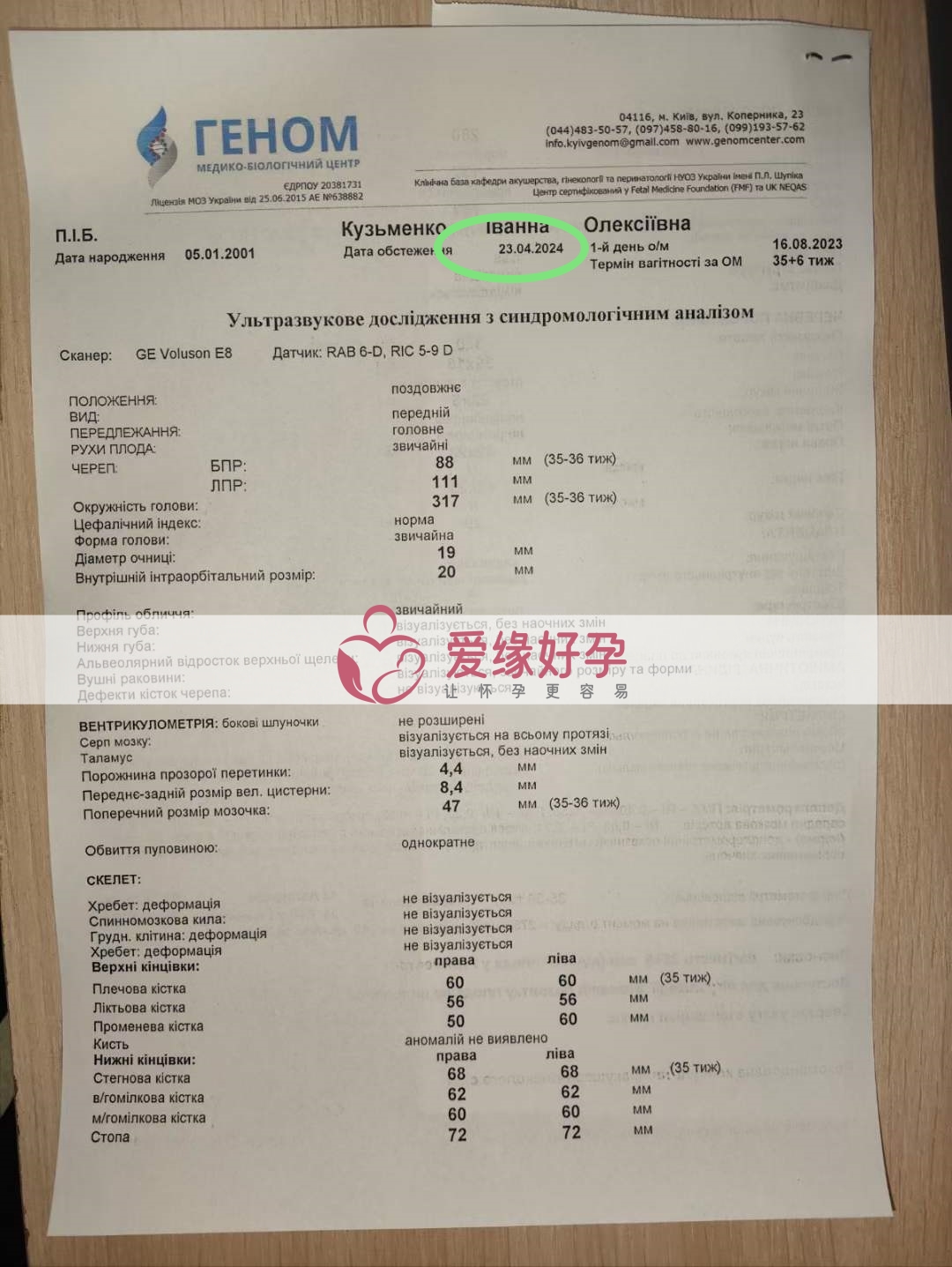 爱缘好孕：乌克兰爱心妈妈35周孕检顺利通过