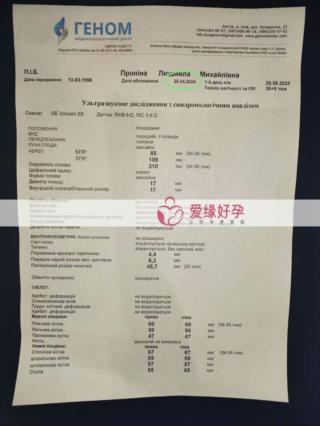 爱缘好孕: 乌克兰爱心妈妈34周孕检顺利通过