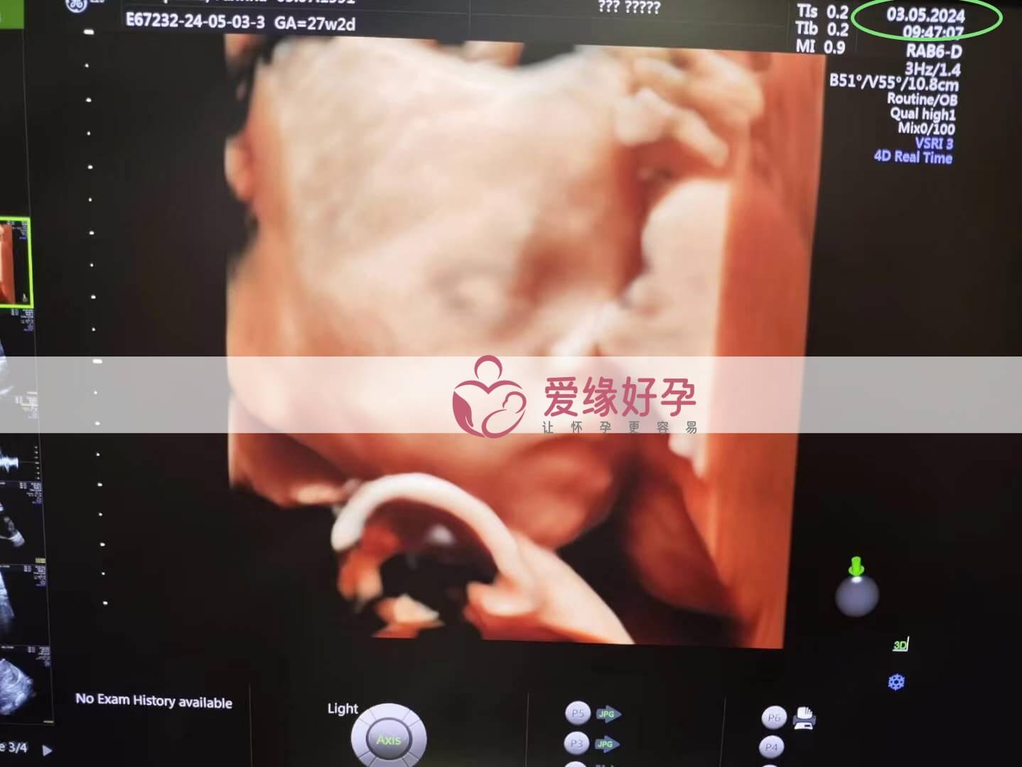 爱缘好孕:乌克兰爱心妈妈孕28周产检顺利通过