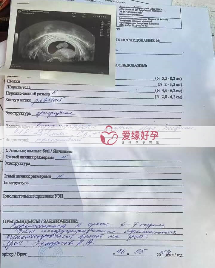 爱缘好孕:哈萨克斯坦爱心妈妈第7周孕检通过