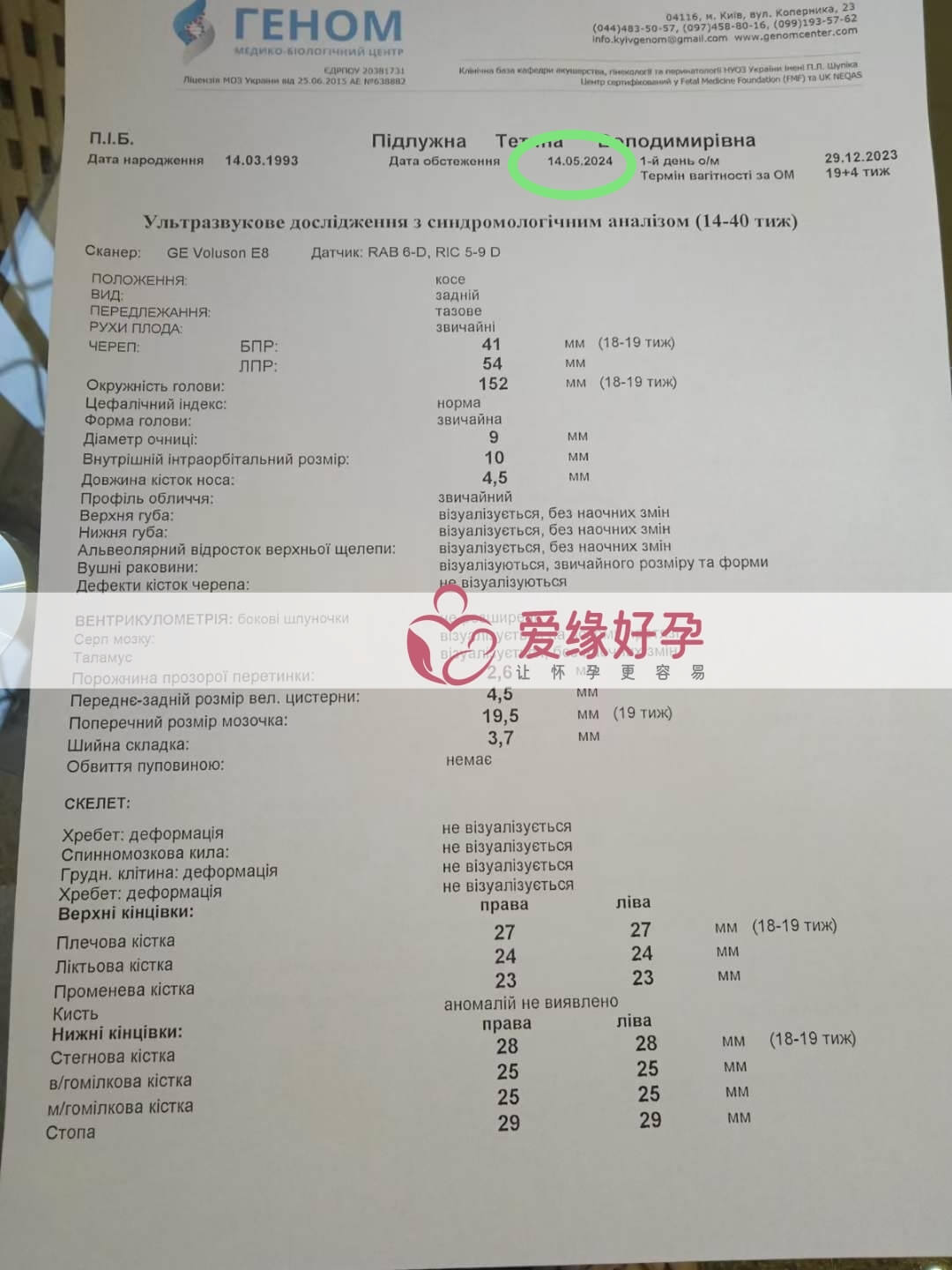 爱缘好孕:乌克兰爱心妈妈18周孕检顺利通过