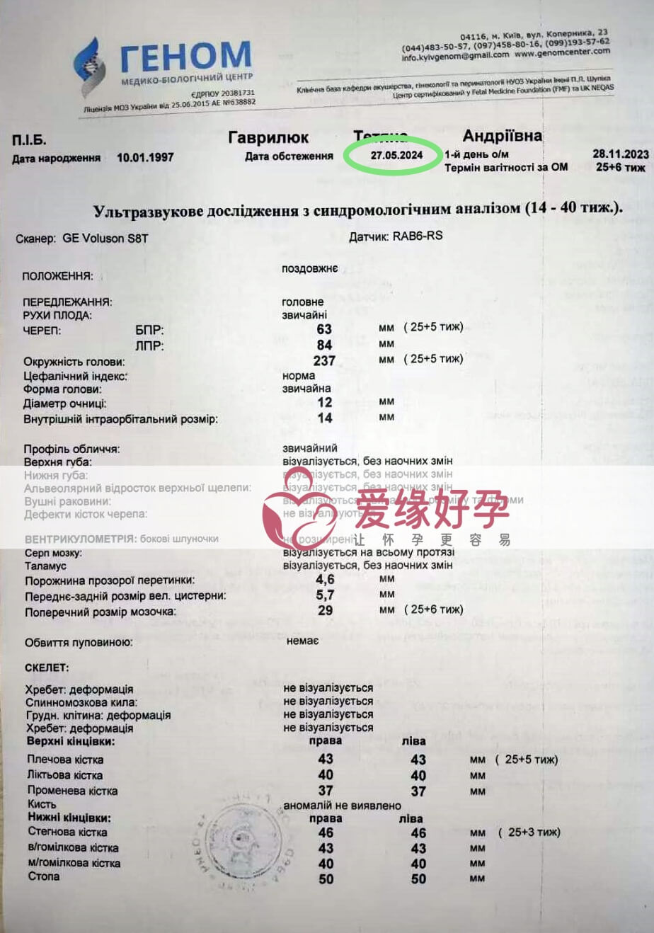 爱缘好孕:乌克兰爱心妈妈25周孕检顺利通过