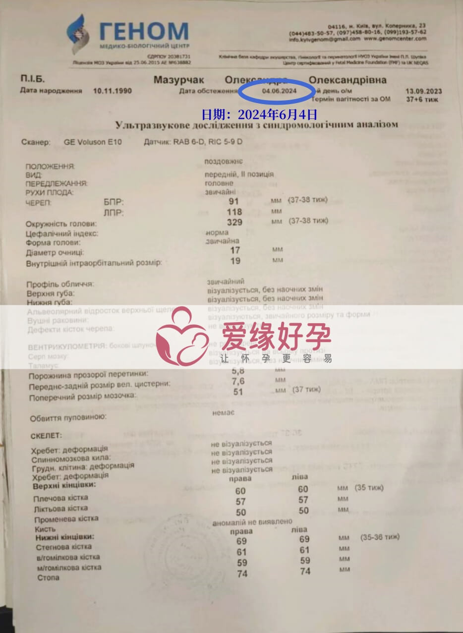 爱缘好孕:乌克兰爱心妈妈孕37周产检顺利通过