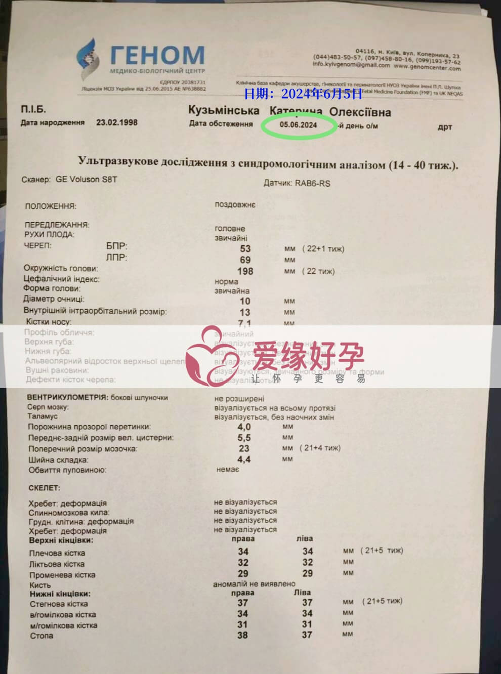 爱缘好孕:乌克兰爱心妈妈孕21周产检顺利通过