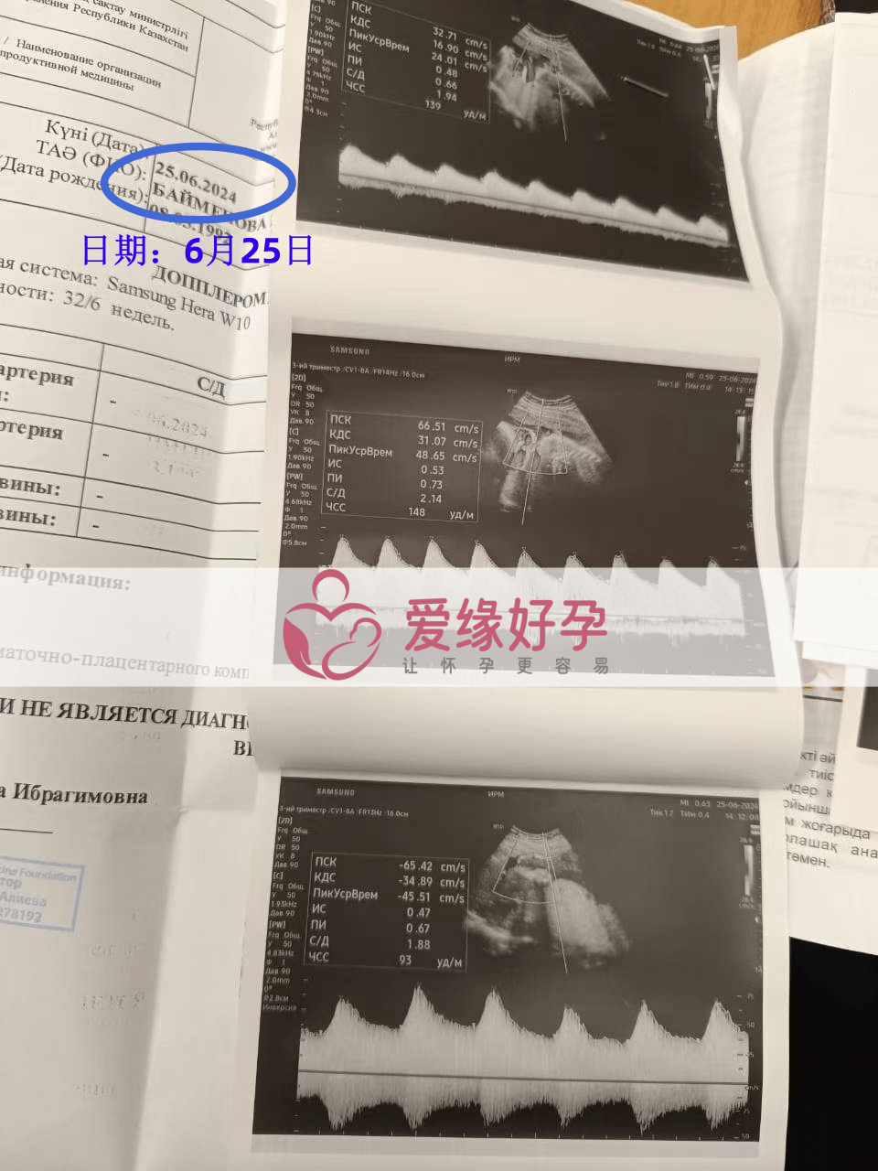 爱缘好孕哈萨克斯坦爱心妈妈孕33周产检顺利通过