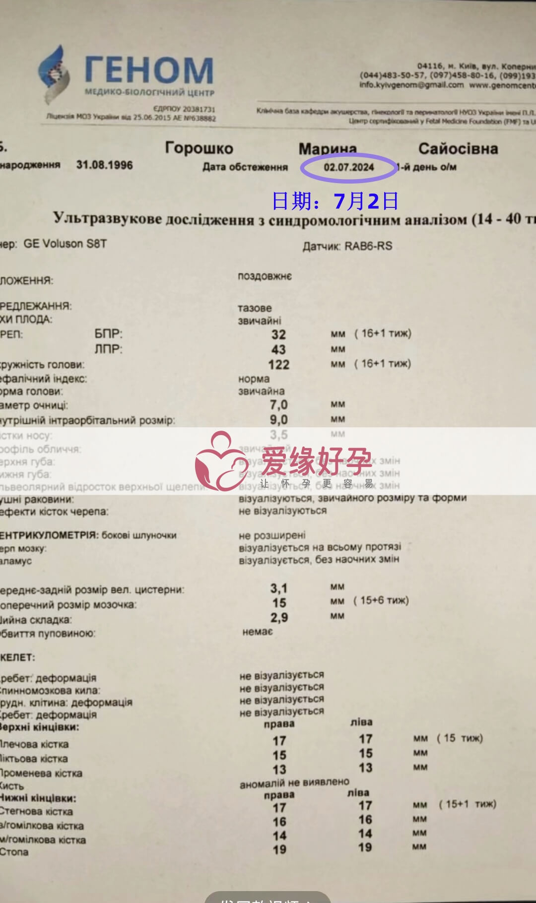 爱缘好孕乌克兰爱心妈妈孕15周产检顺利通过