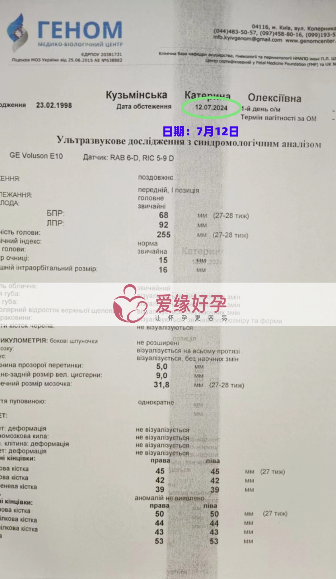 爱缘好孕乌克兰爱心妈妈孕27周产检顺利通过