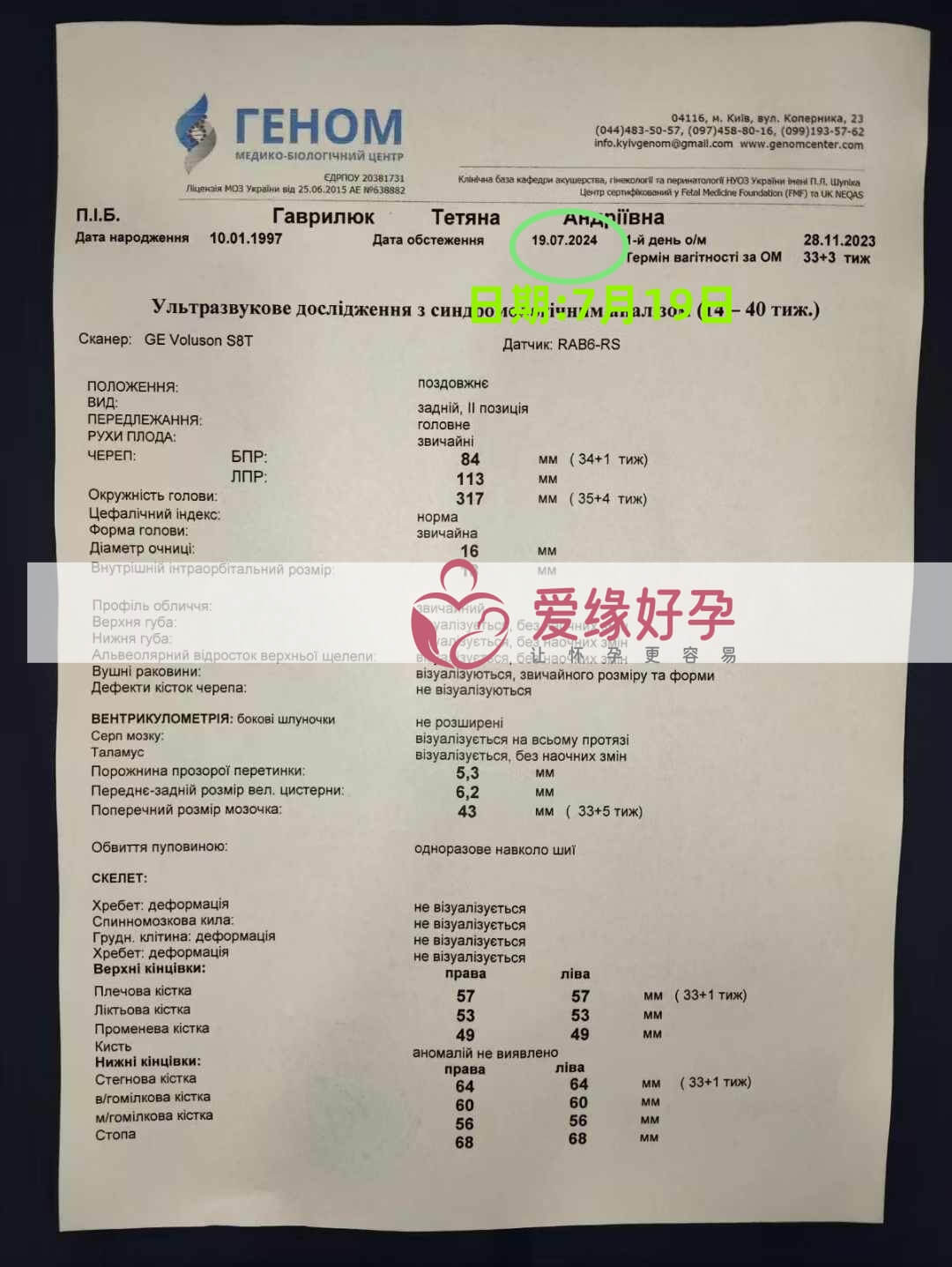 爱缘好孕乌克兰爱心妈妈孕34周产检顺利通过