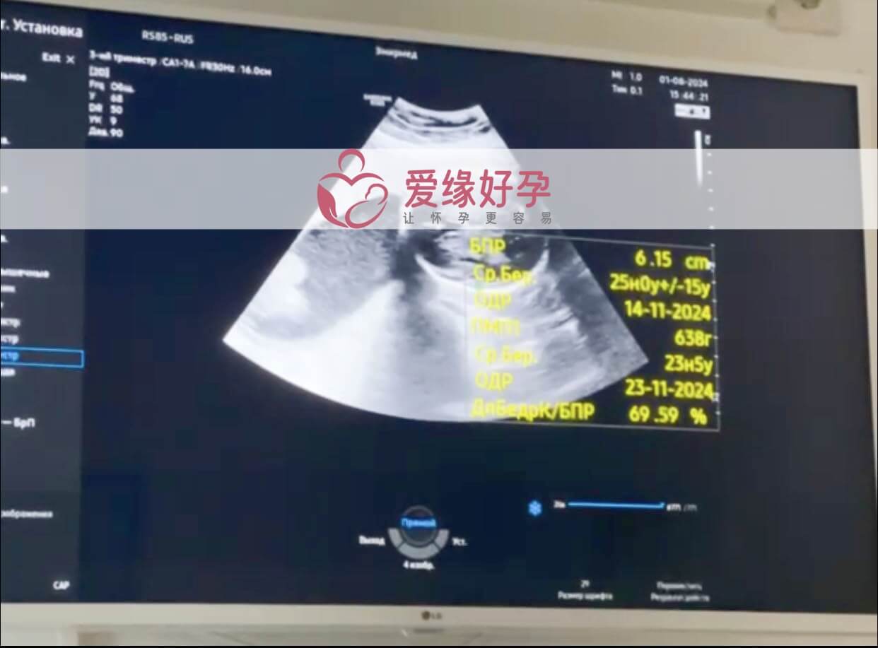 爱缘好孕哈萨克斯坦爱心妈妈孕24周产检顺利通过