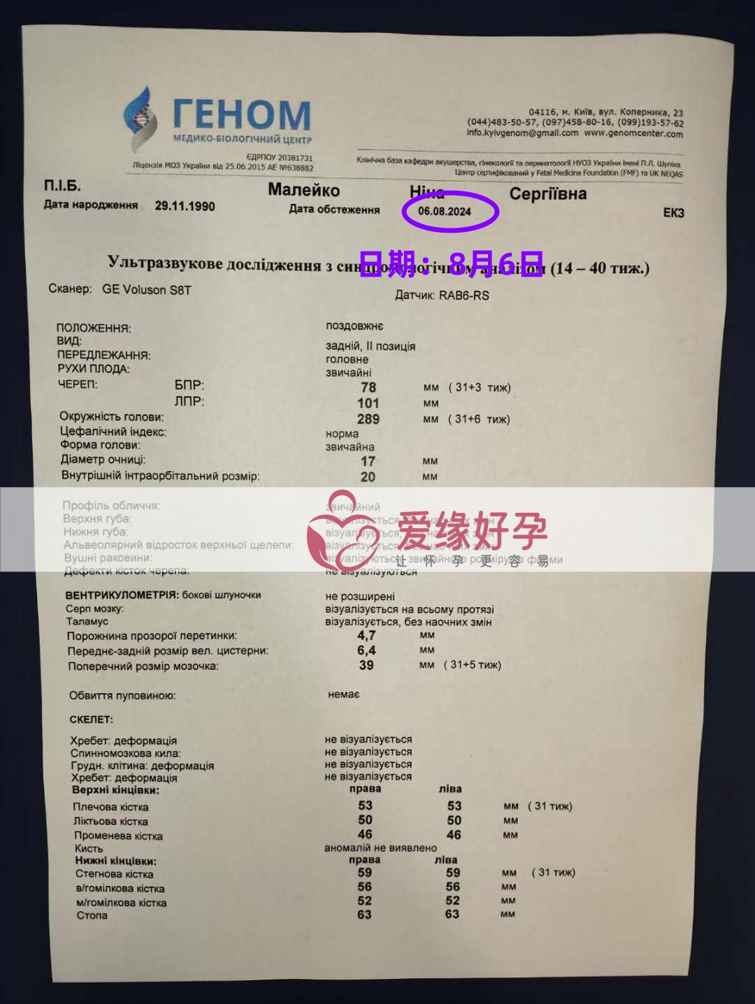 爱缘好孕乌克兰爱心志愿者31周孕检通过！