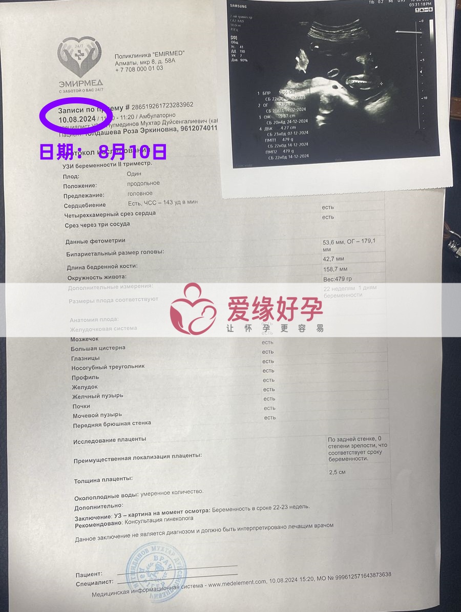 爱缘好孕哈萨克斯坦Z女士夫妇的自暖宝宝22周产检通过！