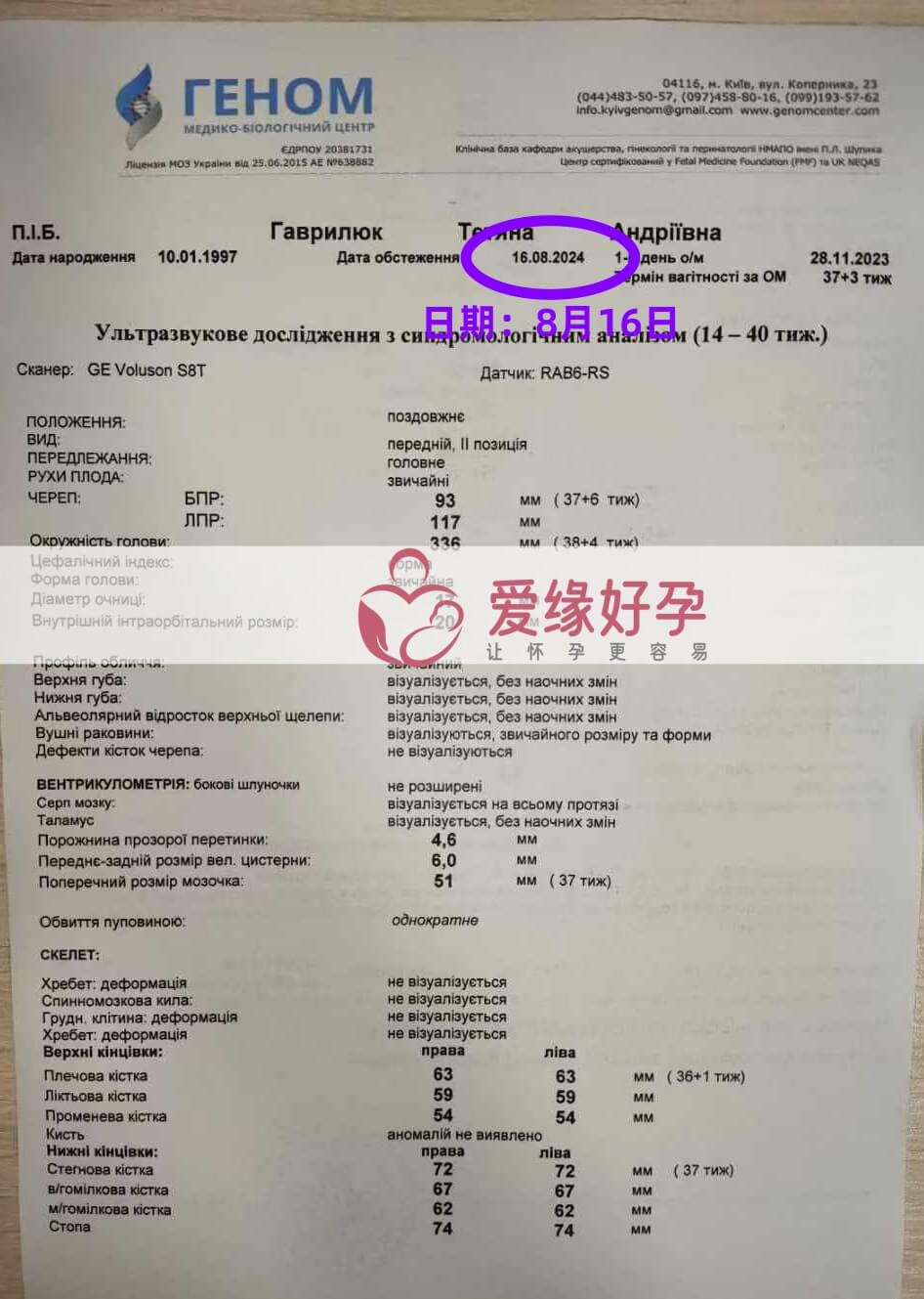 爱缘好孕乌克兰爱心妈妈孕37周产检顺利通过！