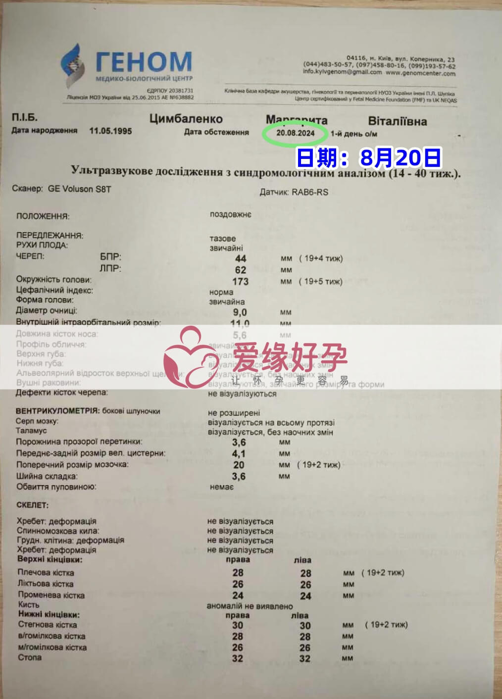 爱缘好孕乌克兰志愿者孕19周产检顺利通过！