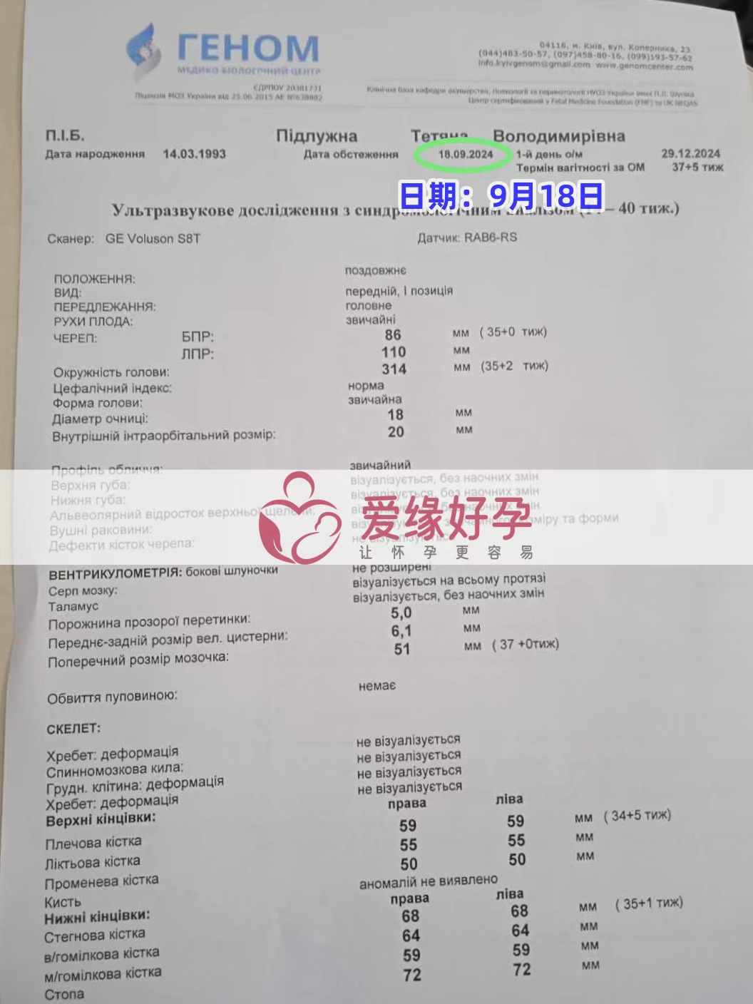 乌克兰爱心志愿者孕35周产检顺利通过！