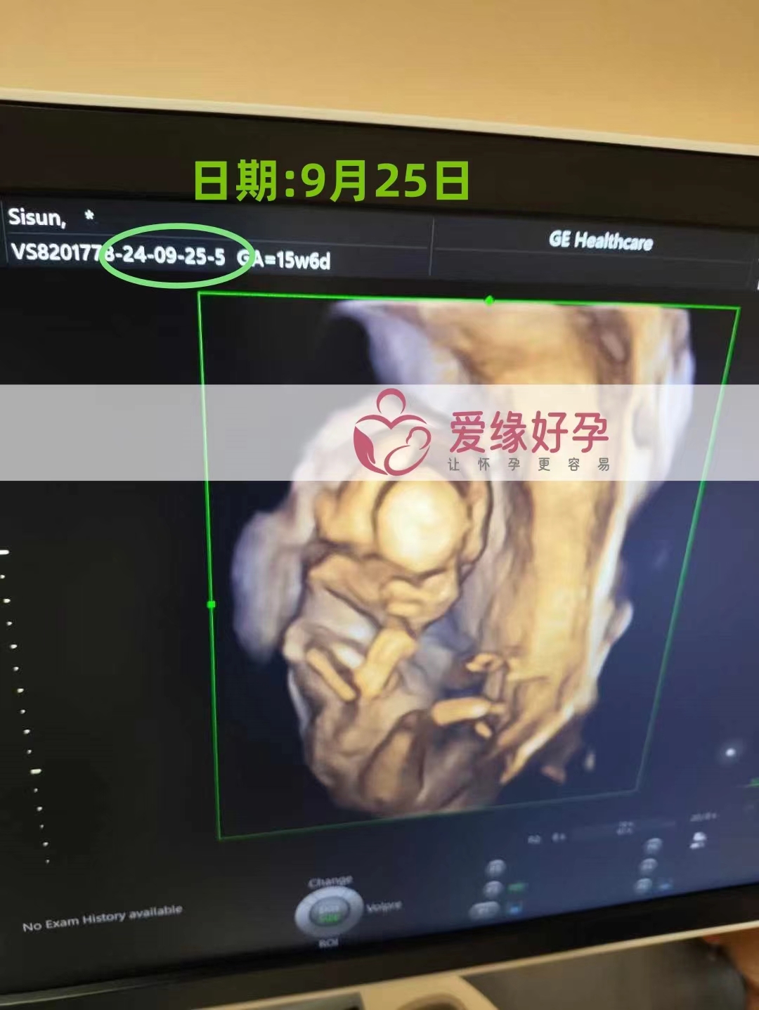 乌克兰爱心孕15周产检顺利通过