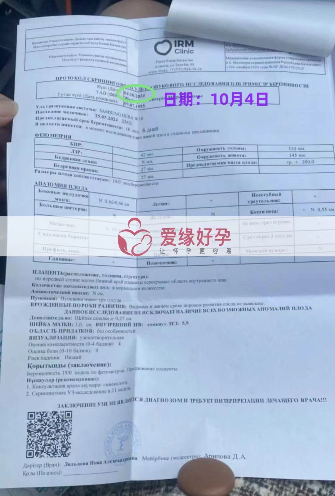 哈萨克斯坦爱心使者孕18周产检顺利通过