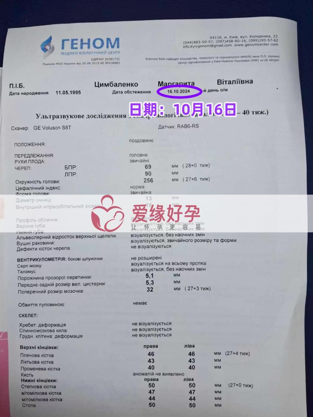 乌克兰爱心使者孕27周产检顺利通过