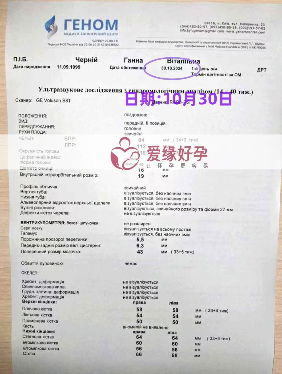 乌克兰爱心使者孕34周产检顺利通过