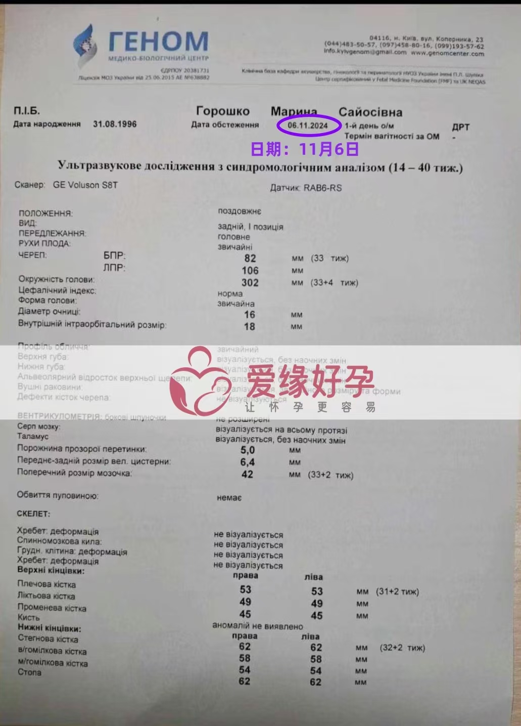 乌克兰爱心使者孕33周产检顺利通过