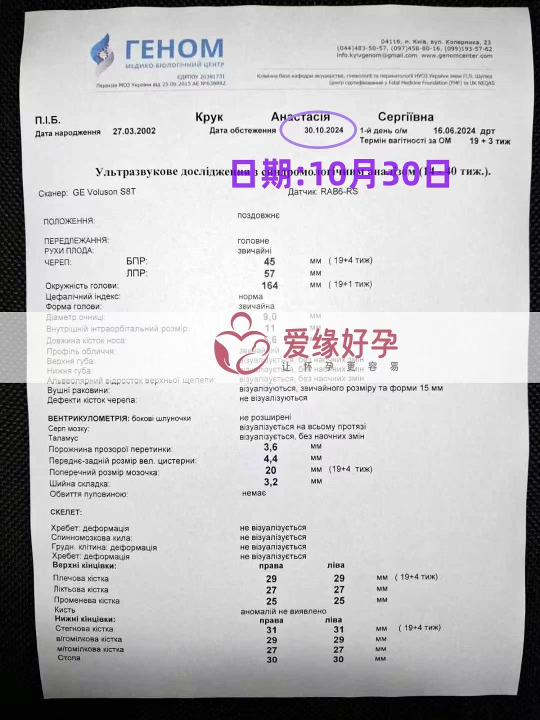 乌克兰爱心使者孕19周产检顺利通过