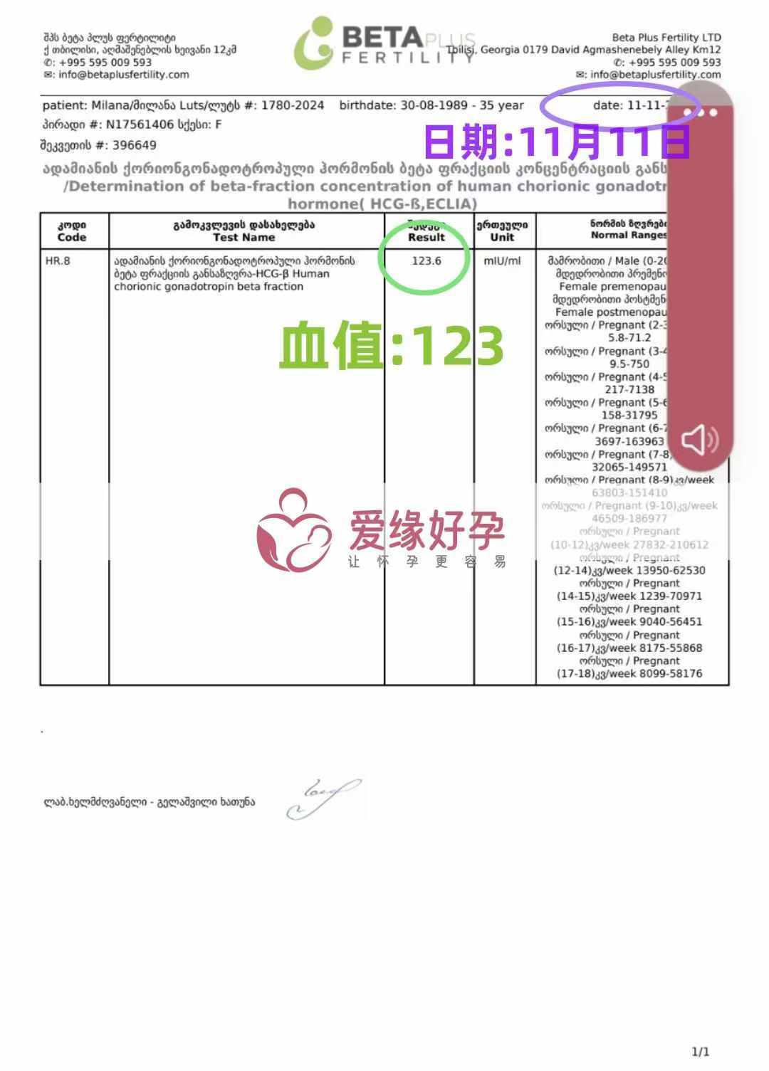 格鲁吉亚爱心使者验孕成功