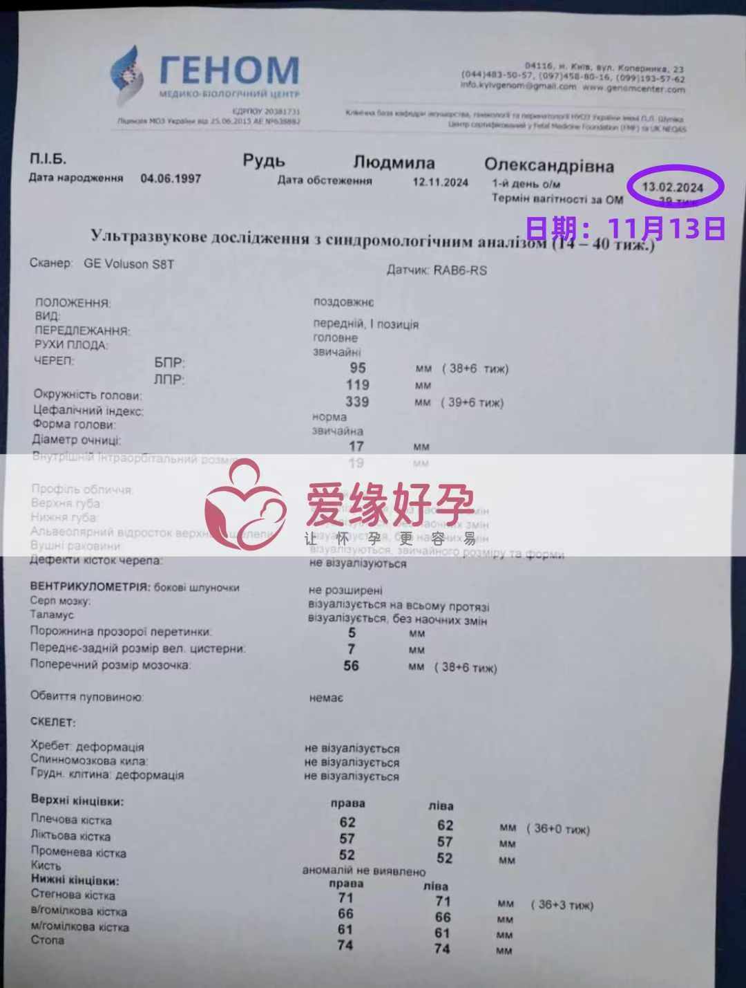 乌克兰爱心使者孕38周产检顺利通过