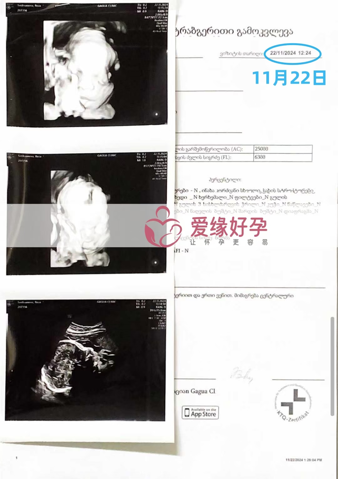 乌克兰爱心使者孕29周产检顺利通过